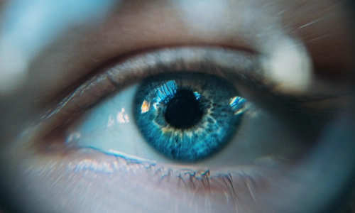 Vision Image